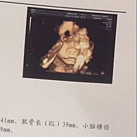 我就想知道这个鼻子是什么意思？猪鼻子？鼻子又大鼻孔又大还朝天鼻？你到底遗传了谁的基因啊，我滴个神...