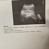 有懂得吗？很担心！