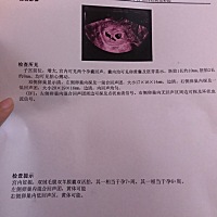 一开始五周流褐色分泌物，去医院检查孕酮跟hcg都还不错，做了第一次阴超有一个类似血块的液性暗区，说只...