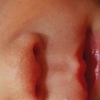 宝宝鼻子上的白色的点是什么啊，感觉像粉刺一样的