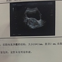 或许人生就是这样，该来的会来，该走的会走！今天做B超医生让住院做了，四天了一点没长还是有胎芽无胎心...