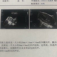 今天刚做的彩超，结果是已经八周四，自己算的是七周一，开始严重怀疑自己的记忆了！数据应该都正常吧？...