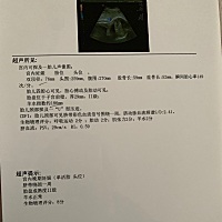 有没有脐带绕颈的！这种要怎么办？