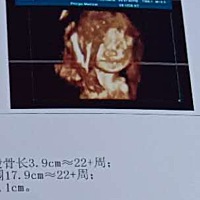 越到后期越累，还是老公对我无微不致的照顾