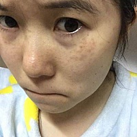 我脸怕是要费了，生完宝宝后我脸上就出现很多斑点，怎么办。。。。