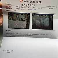 老二是个意外，双胞胎更是个意外，有些哭笑不得！以后家里三个宝贝啦，接好孕啦！