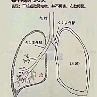 最近很多宝妈在问咳嗽，分享下宝宝咳嗽的三个阶段