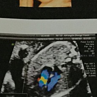 请问这是男宝宝还是女宝宝啊