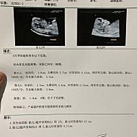 今天检查了NT，看见两个小猪猪睡上下铺的样子一模一样，好可爱。