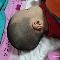 这头怎么这样，越长越长了，正常吗？好想让他平躺，可是奶睡都是侧着身子吸着睡着，放平立刻就醒可咋整啊