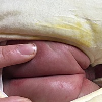 唉，孩子对不起，妈妈没照顾好你，你穿这么厚热的出汗，妈妈没决定权脱，晚上又电热毯，