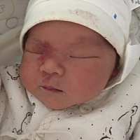 宝宝生出来脸上就有红色一块，医生说是血管瘤，好担心咯，有没有同样的，这个能搞好吗，女宝宝在脸上，...