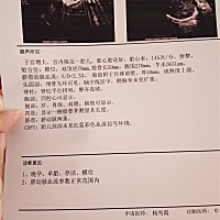 帮忙看看男孩女孩