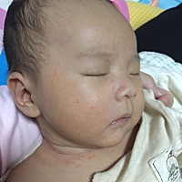 脸上这是湿疹吗？