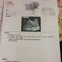 今天做的NT，看不懂，医生说可以