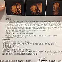 四维顺利通过、懂得宝妈进来看看是男孩女孩