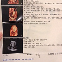 姐姐们 男孩女孩？