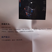 这个点睡醒了，昨天去检查，没看到早孕，只看到子宫内膜增厚，想问下孕妈妈们你们有过吗？