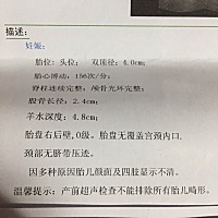 今天b超医生说宝宝腿长。 是不是代表是女儿啊。都说腿长是女儿。头大是儿子。 求助～