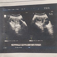 各位大神们，这样能看出是男宝还是女宝吗？ 七周➕5天