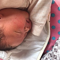 这是热的还是湿疹？