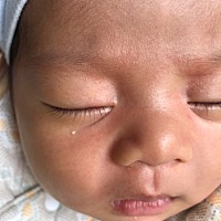请问有没有宝妈知道孩子脸上一出生就有这个白色颗粒，要怎样处理啊？？？有知道的宝妈留下方法哦！！！