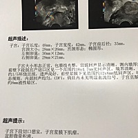 关于剖腹产后遗症有生二胎的姐妹们吗？ 我的刀疤有切憩，医生开了中药慢慢调理，医生说这种生二胎有...