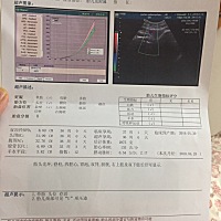 宝宝绕颈一周，希望自己能绕回来，健康平安顺利顺产，菩萨保佑🙏