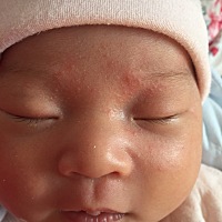 宝宝脸上突然起小疙瘩，有谁知道这是怎么回事儿？