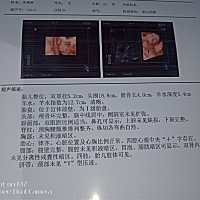 谁会看单子，男孩儿还是女孩儿，有点好奇😃