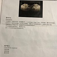 请大家帮我看一下，这个问题严重吗，通过一次保胎第二次照好了很多，因以为没事了自己大意就没注意休息...