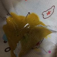 宝宝一个月 一直吃母乳 今天发现拉这种稀的还带沫的粑粑 有知道是怎么了吗