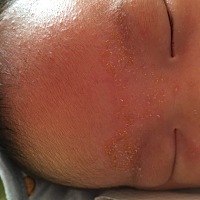 宝宝脸上长了好多这种的，最开始是眉毛长了一点，这几天嘴巴脸上，脖子上都长了头发里面也全是白色的颗...