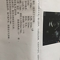 各位知道大概什么时候生吗，快了吗