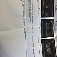 憋尿很痛苦，总算检查出来😄