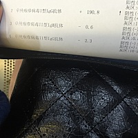 今天拿到结果又变这样了