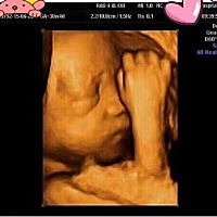 刚做的四维彩超，宝宝竟然在抠鼻子，啊宝你这是惊喜还是惊吓呢？