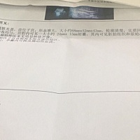 今天刚做的B超，希望一直顺利🙏🏻🙏🏻