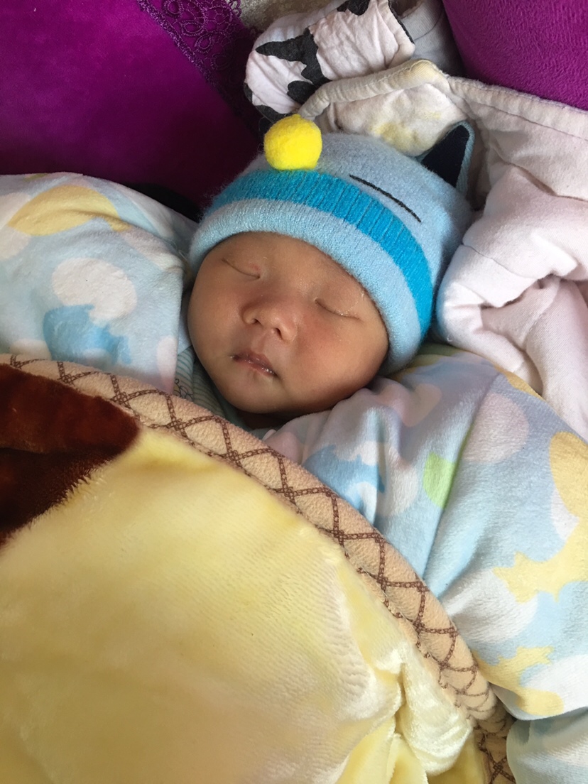 前后相差十天的模样 黄疸明显好转