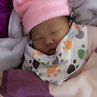 前后相差十天的模样 黄疸明显好转