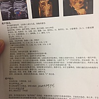 有准妈妈跟我一样是肺动脉比主动脉较窄的吗？糟心