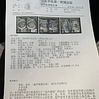 高手来帮我看看男宝还是女宝哈