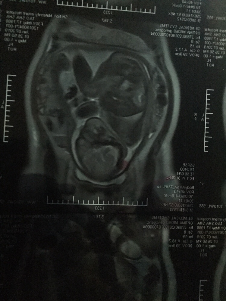 有谁知道，这样算入盆了吗