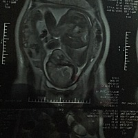 有谁知道，这样算入盆了吗