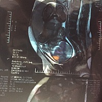 拿到核磁共振成像，惊呆了，好像拍到了敏感部位了？不用避讳一下的吗？😂