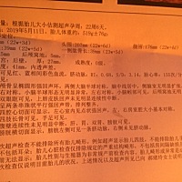 男孩女孩啊？大宝是男孩，二胎想要女儿想疯了