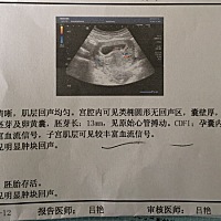 医生说宝宝很健康，很好，心里的石头总算落下，最近孕吐实在严重🙁