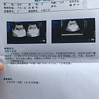 双胎，NT一切正常 不过我觉得检查的有点潦草