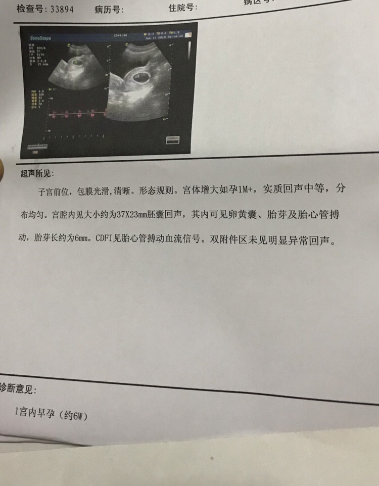 听到心跳声，满满的爱