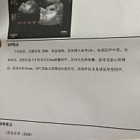 听到心跳声，满满的爱